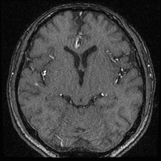 Click on the Serie image to view the images of VILLANUEVA, WILLIAM A.